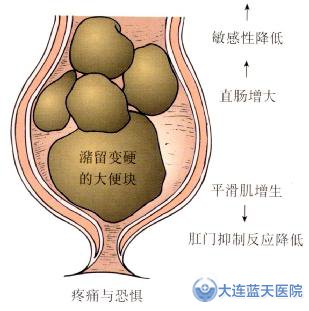 大连胃肠科医院萎缩性胃炎预警信号！